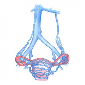 Pelvic Congestion Syndrome at Intermountain Vein Center