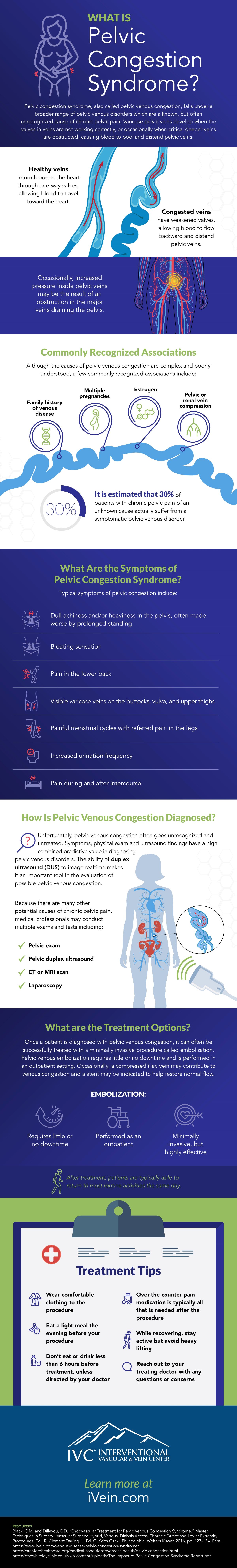 infographic describing pelvic congestion syndrome