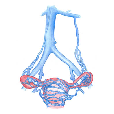 Pelvic Congestion Syndrome at Intermountain Vein Center